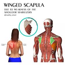 Image result for Winged Scapula