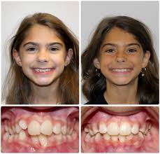 Congratulations Edna