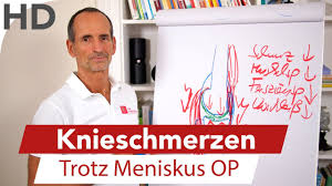 Knieschmerzen Trotz Meniskus Op Ursachen Ubungen Youtube