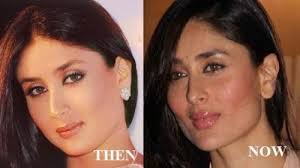 Kareena Kapoor Plastic Surgery Before And After Nose And Lips Plastic Surgery Physical Beauty Beauty Hacks