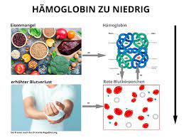 Hamoglobin Zu Niedrig Blutwerte