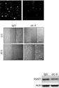 Interleukin-6 mediates PSAT1 expression and serine metabolism in ...