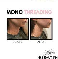 Pin On Thread Lift Treatment