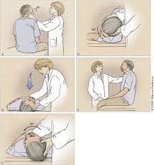 Treatment Of Vertigo American Family Physician