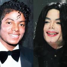 Pembedahan plastik dalam islam ᴴᴰ i ustaz anwar hussain. Islam Dan Biotechnology Dalam Mendepani Isu Isu Semasa Pembedahan Plastik Dan Bayi Islam Medepani Isu Isu Pembedahan Plastik Dan Bayi Tabung Uji Facebook