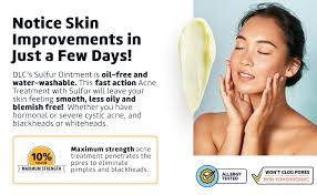 Letter to employees regarding teamwork / american. Amazon Com De La Cruz 10 Sulfur Ointment Acne Treatment Medication To Clear Cystic Acne Pimples And Blackheads On Face And Body Made In Usa 2 6 Oz 3 Pack Pore Cleansers Health Household