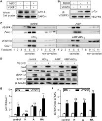 The right thoracic duct is connected directly to the subclavian mediastinum structures are structures located inside the thoracic cavity. Aibp Cav1 Vegfr3 Axis Dictates Lymphatic Cell Fate And Controls Lymphangiogenesis Biorxiv