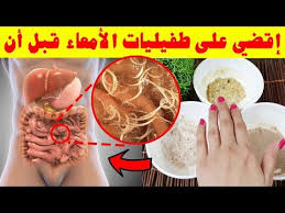 خطير أسرع علاج طبيعي للطفيليات المعوية من اول استعمال تخلص من الديدان المعوية بطريقة منزلية بسيطة Youtube The Creator