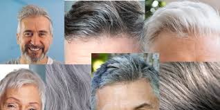 CANAS: ¿CUÁLES SON LAS CAUSAS Y CÓMO COMBATIRLAS? | El blog Kmax