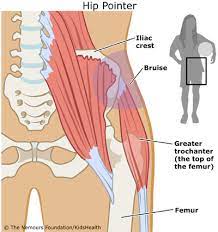 Targeted hip and knee strengthening online course: Hip Pointer