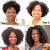 3 Years Hair Growth Female