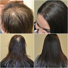 Instead of using glue to attach the extension, a strong tape is used instead. About Hair Extensions Page 2 Di Biase Hair Extensions Usa Store
