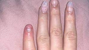 Help I Just Healed My Natural Nail Beds I Had Clear Pink Acrylic Extensions On And One Snapped Taking Most Of My Real Nail With It I M Heart Broken And In So