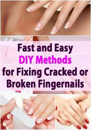 A bruised fingernail is something you have to take care of carefully. Fast And Easy Diy Methods For Fixing Cracked Or Broken Fingernails Diy Crafts