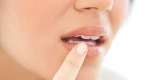 Herpes infections can be latent or active. Can You Get Herpes From Kissing
