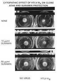 Image result for Suramin