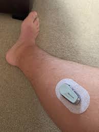 The app won't open unless it passes as a compatible. Mission Accomplished Boys Weird Place To Put A Cgm No 5 Diabetes