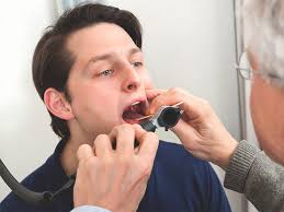 Strep throat or throat cancer? Throat Ulcers Causes Symptoms Treatment And Prevention
