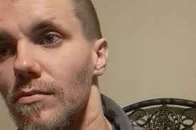 Fundraiser by Kendel James : 2 abcsessed molars