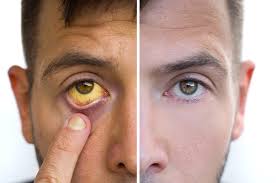 Image result for Sclera