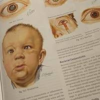 Netter's Pediatrics (Netter Clinical Science): Tenney Soeiro MD MSEd,  Rebecca, Pete Devon MD, Erin: 9780323796088: Amazon.com: Books