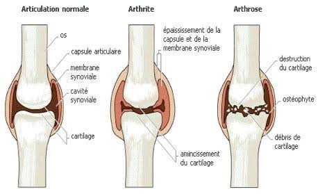 Chroniques - Physio Interactive