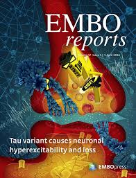 Expression of A152T human tau causes age‐dependent neuronal dysfunction and  loss in transgenic mice