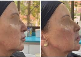 Clínica Dra. Azcárate