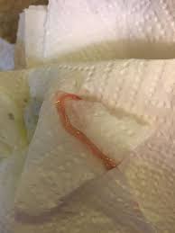 A cough that causes them to collapse; Coughing Up Blood Backyard Chickens Learn How To Raise Chickens