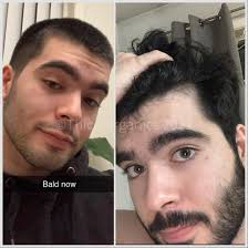 Thicc Organics Organic Hair Growth Oil Based On clinical studies