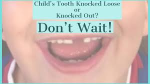 Seemingly so loose that someone who wasn't a dentist could think they could pull it out themselves easily and painlessly. What To Do If My Child Knocks A Tooth Loose Or Completely Out Rhoades Dentistry