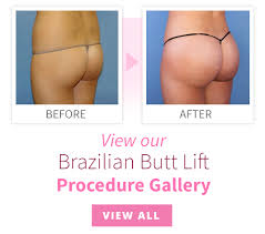 The average cost of breast augmentation with fat transfer in the us is around $6,525, depending upon the plastic surgeon or the clinics. Brazilian Butt Lift Surgery Ocala Plastic Surgery