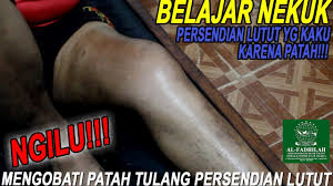 Obat penghilang nyeri betis lengan dan otot tangan kaki paha. Ngilu Terapi Nekuk Patah Tulang Lutut Pengobatan Al Fadhilah 152 Youtube