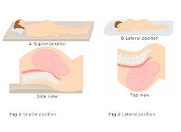 It S Probably Safe To Sleep On Your Back While Pregnant Expecting Science