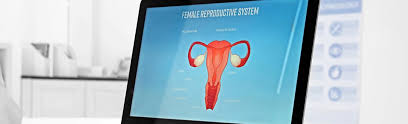 A endometriose é caracterizada pelo crescimento de tecido endometrial fora do útero, em locais como os intestinos, ovários, trompas de falópio ou bexiga. Endometriose Und Fruchtbarkeit Fruchtbarkeitsberatung News Vitanova