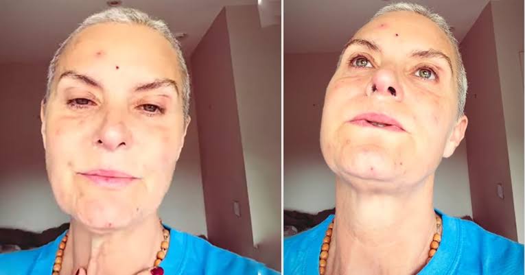 Coronation Street's Tracy Shaw rushed to A&E amid chemotherapy journey |  Soaps | Metro News