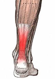 Achilles Tendonitis In Runners A Degenerative Overuse Injury Best Treated With Eccentri Achilles Tendonitis Tendonitis Treatment Achilles Tendonitis Treatment