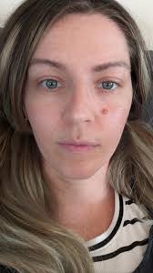 Has anyone successfully gotten lip/cheek tint out of their clothes??  Stained my new Gorman dress