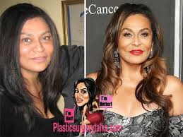 Tina Knowles Plastic Surgery Before After Plastic Surgery Tina Knowles Celebrity Plastic Surgery
