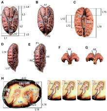 Image result for Cyphostemma paucidentatum