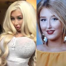 Amanda Ahola, a 22 anni dipendente dalla chirurgia plastica (per  assomigliare a Barbie)