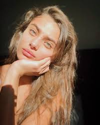 Taylor Hill se ha convertido en la modelo más natural de Instagram. No es  la primera vez que muestra su acné y manda mensajes de aceptación. Todas  tenemos ojeras, acné, manchas... y