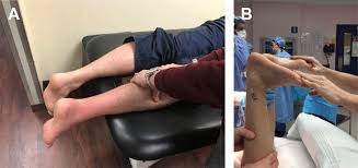 Maybe you would like to learn more about one of these? Functional Rehabilitation For Nonsurgical Treatment Of Acute Achilles Tendon Rupture Foot And Ankle Clinics