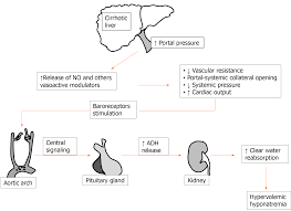 Doctors have two main goals in treating this disease: Natremia And Liver Transplantation The Right Amount Of Salt For A Good Recipe