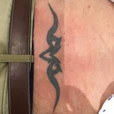 Read more about how we are addressing the current situation. Tattoo Removal Session By Session Gallery Taketatt Tattoo Removal