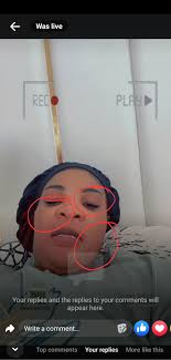 Dangers of using Mai Titi's Feliglow skin creams👇 nyaya yese iyo.