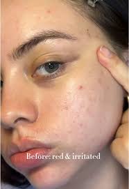 Melba Whitehead Kaura