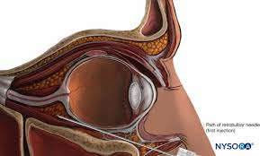 Image result for Periapical Block