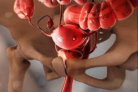 ما هي بطانة الرحم المهاجرة وما أعراضها اندبندنت عربية