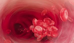 Image result for Protein C Deficiency